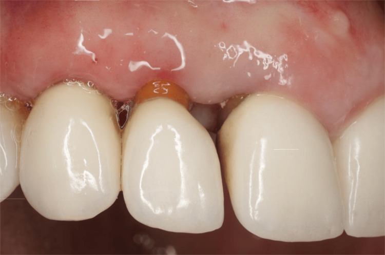 Figure 19