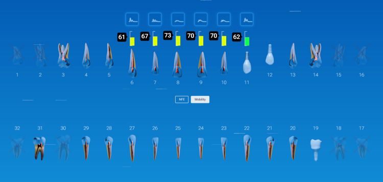 Figure 20