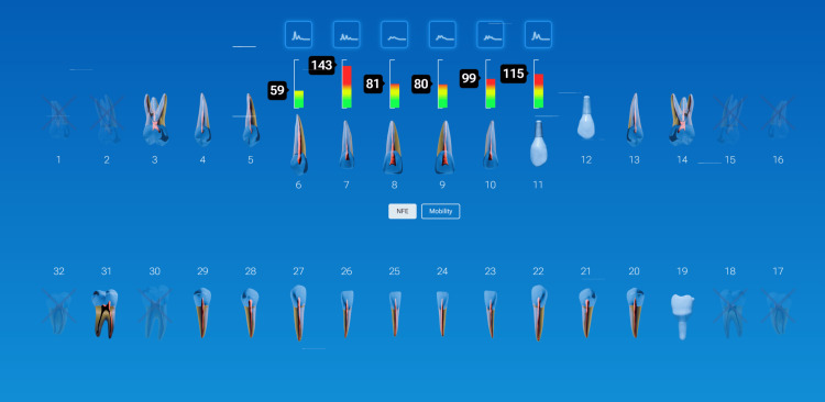 Figure 21