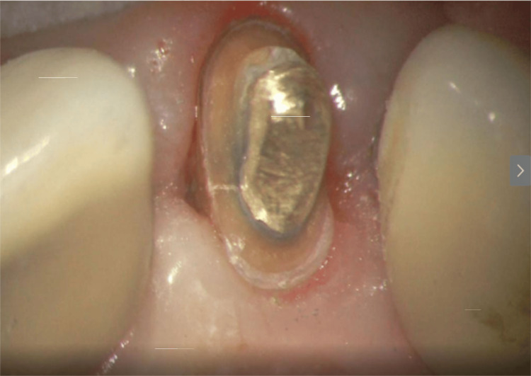 Figure 22