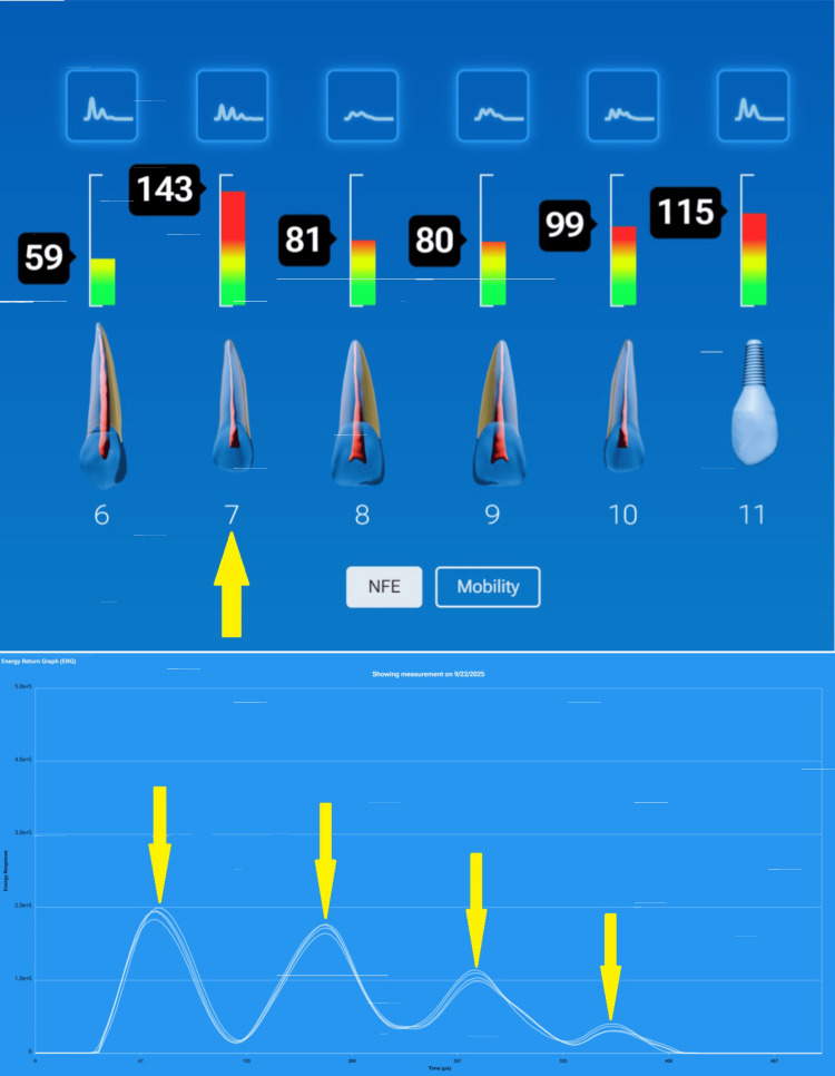 Figure 23