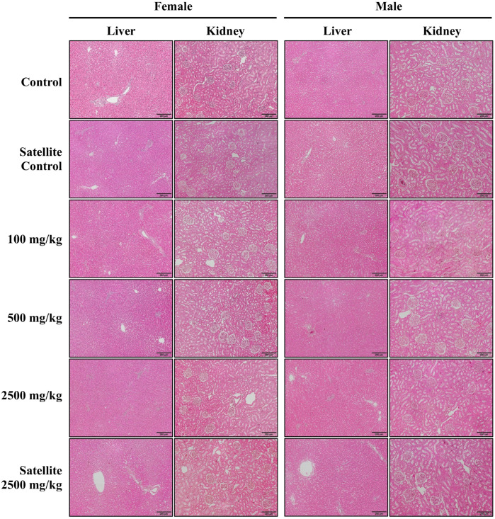 Figure 11
