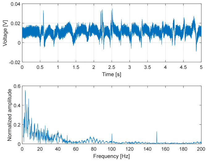 Figure 14