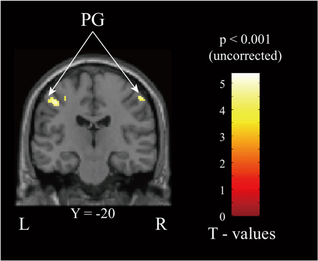 Fig 12
