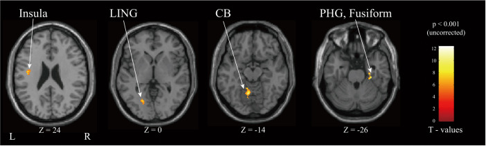 Fig 13