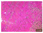 Figure 44