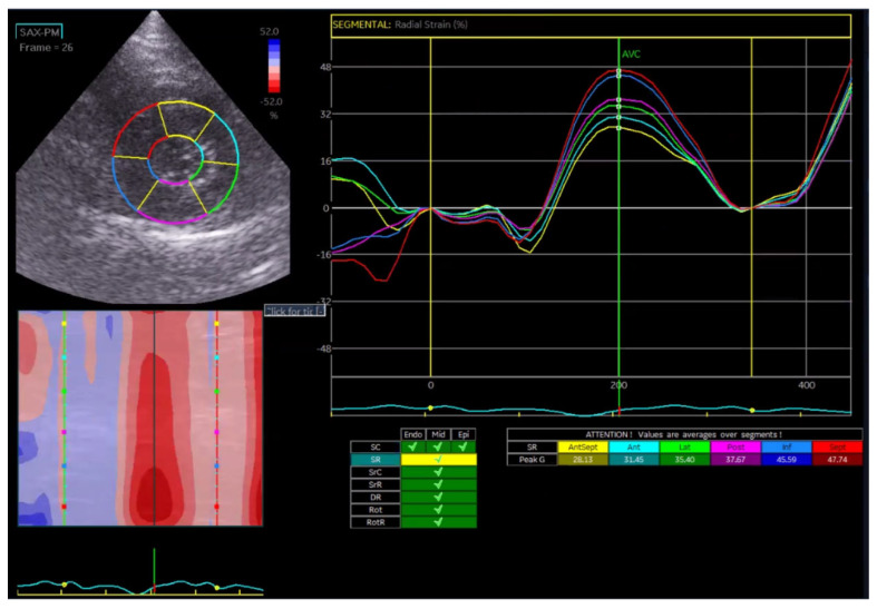 Figure 12
