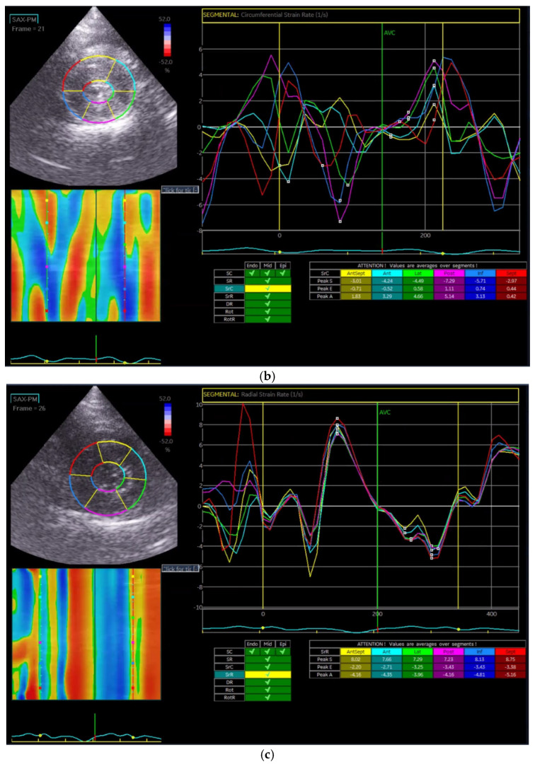 Figure 14