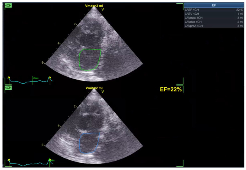 Figure 15