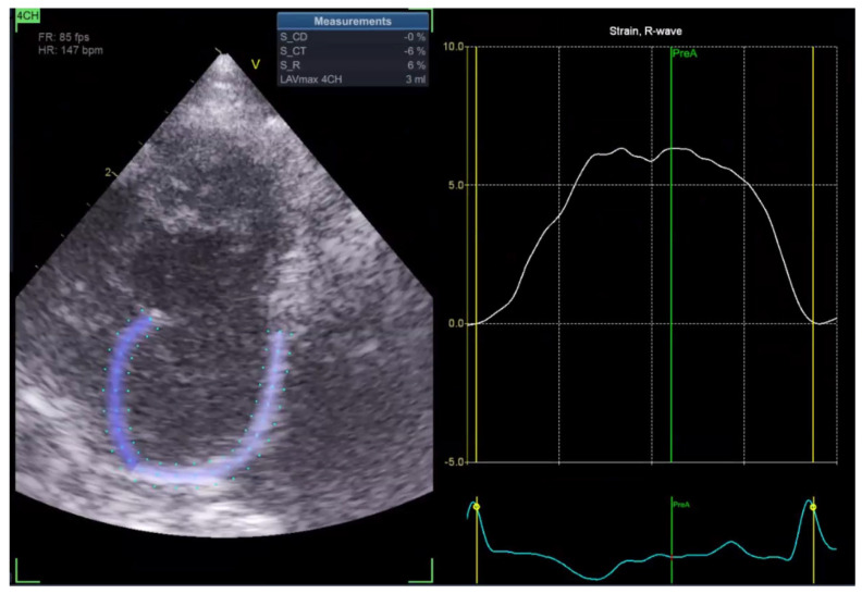 Figure 16
