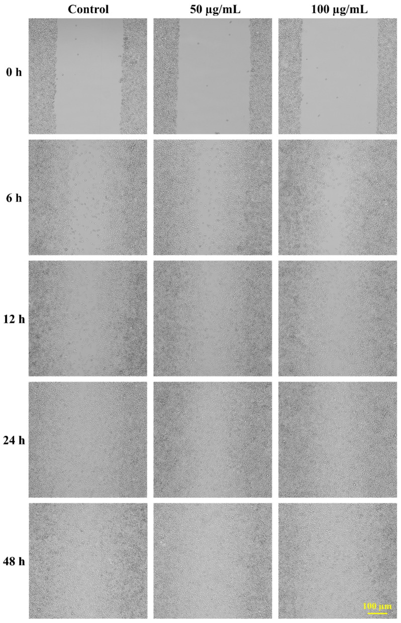 Figure 12