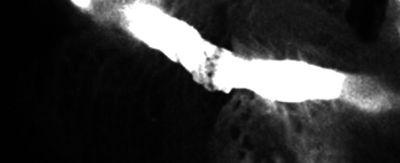 Fig. 11