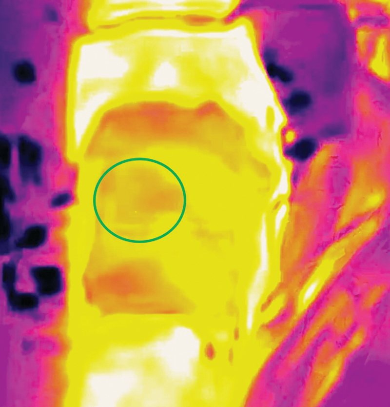 Fig. 14