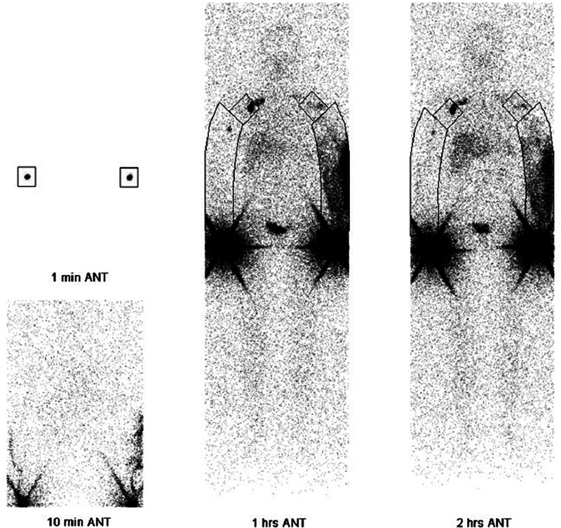 Fig. 15