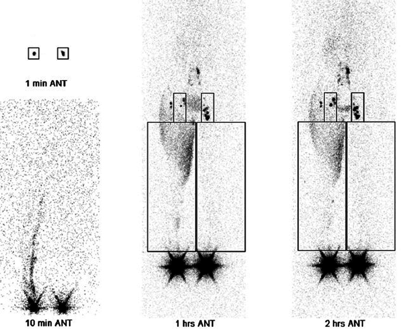 Fig. 16