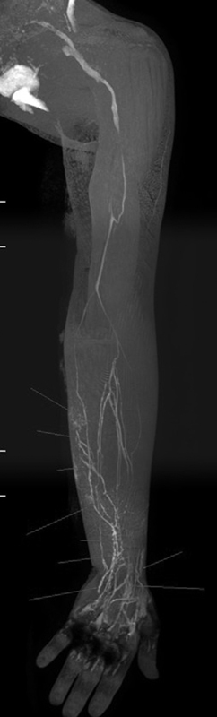 Fig. 17