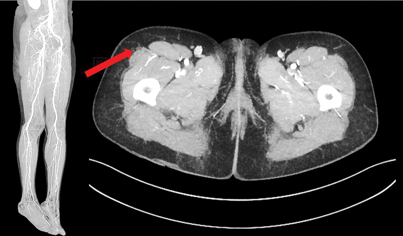 Fig. 19