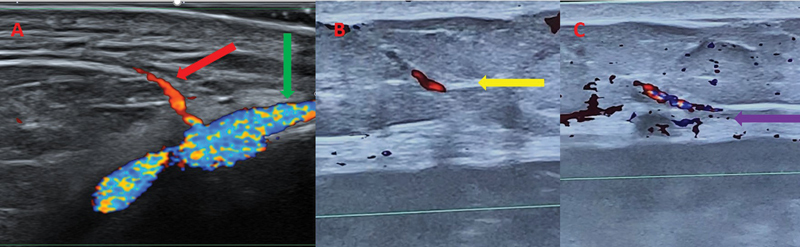 Fig. 20