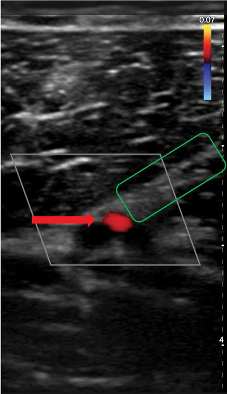 Fig. 5
