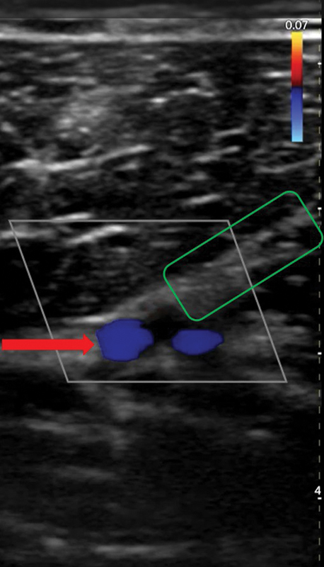 Fig. 6