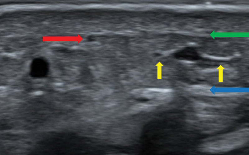 Fig. 8