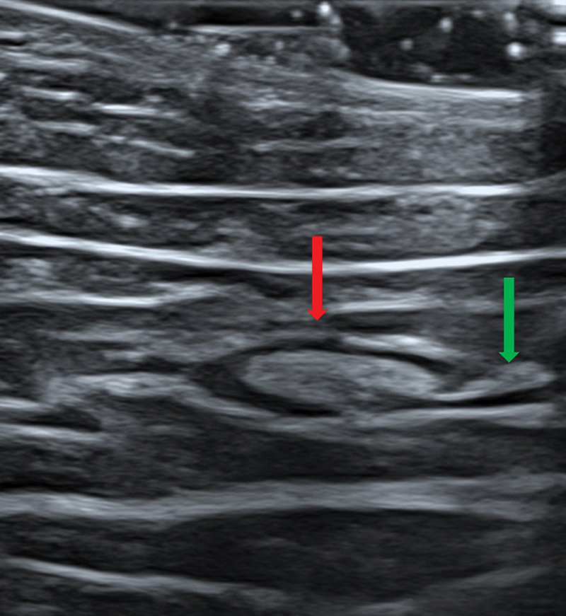 Fig. 9