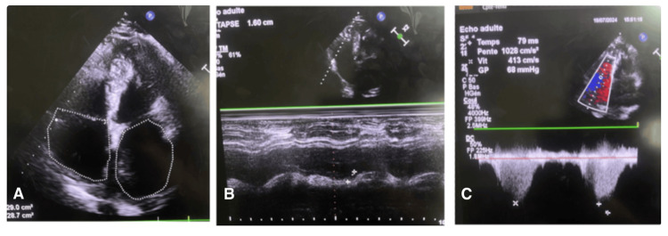 Figure 4
