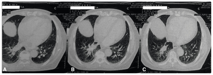 Figure 6