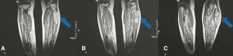 Figure 9