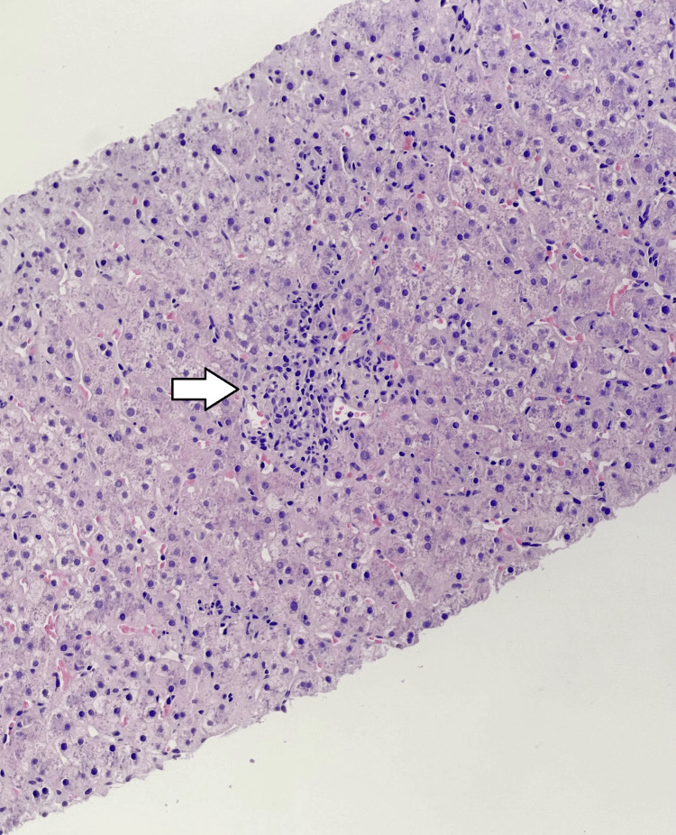 Figure 9