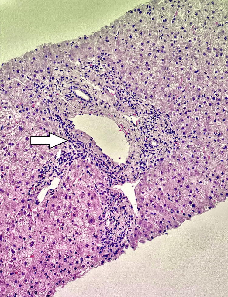 Figure 10