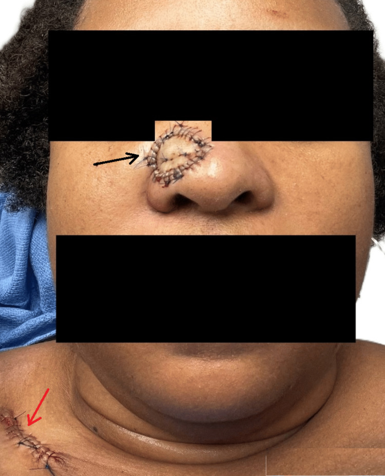 Figure 10