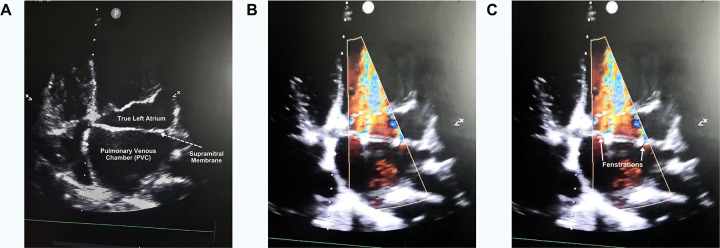 Figure 3