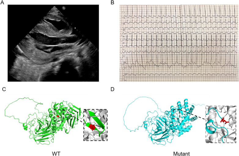 Figure 1