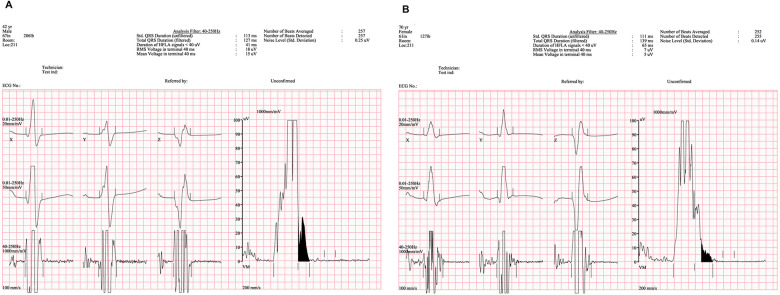 Figure 2