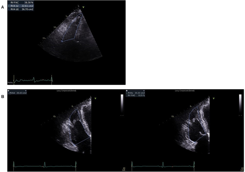 Figure 4
