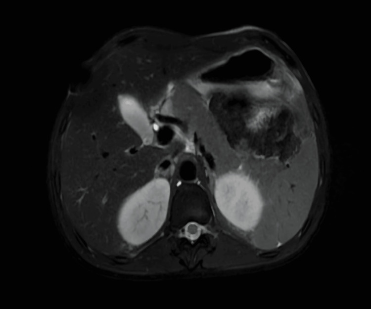 Figure 9