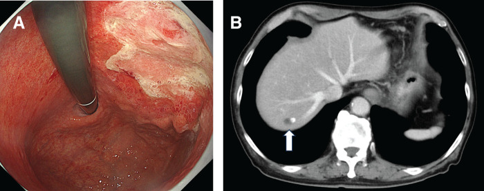 Fig. 5