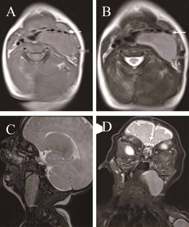 Figure 2