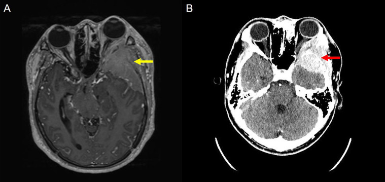 Figure 2