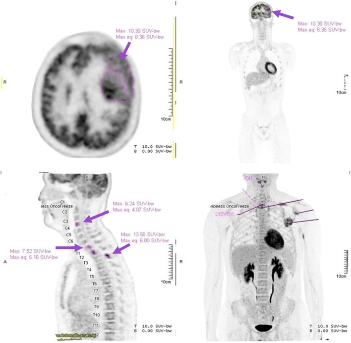 Figure 3