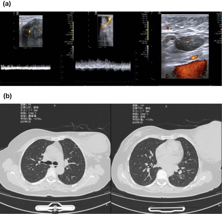 Figure 2