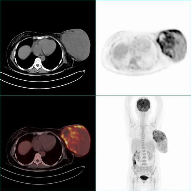 Figure 3