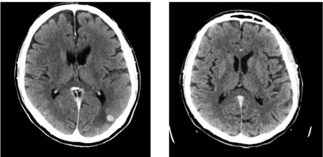 Figure 2