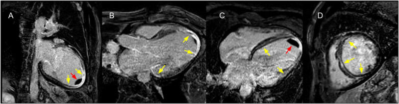 Figure 10