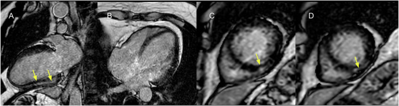 Figure 11