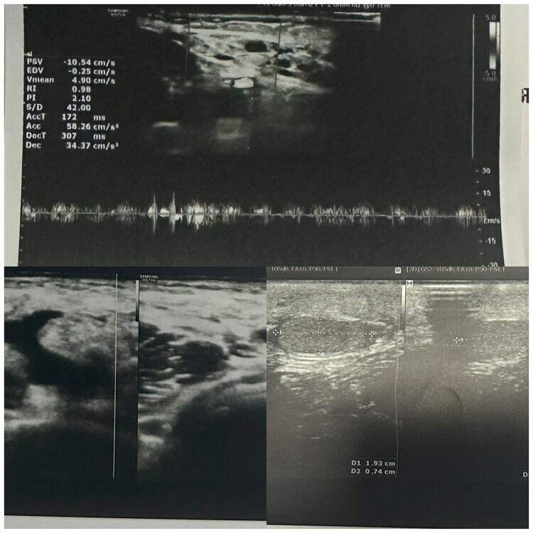 Figure 4