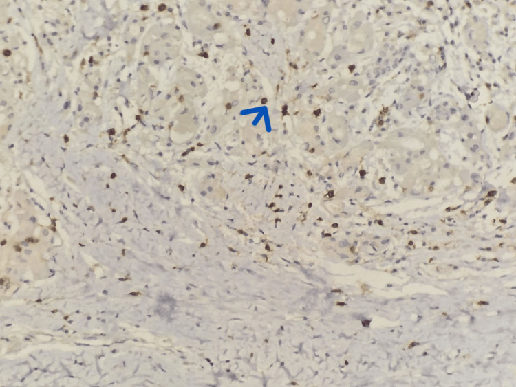 Figure 9