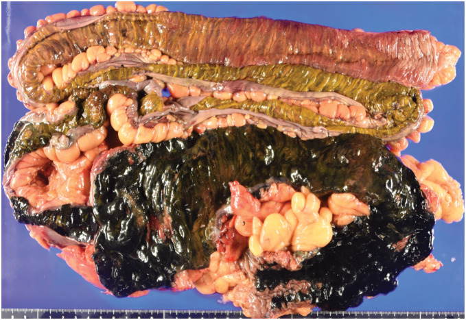 Fig. 4