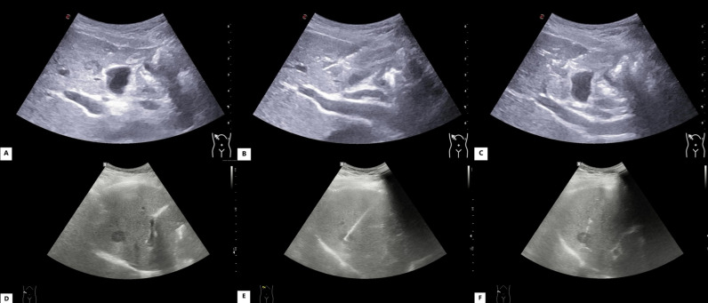 Figure 2